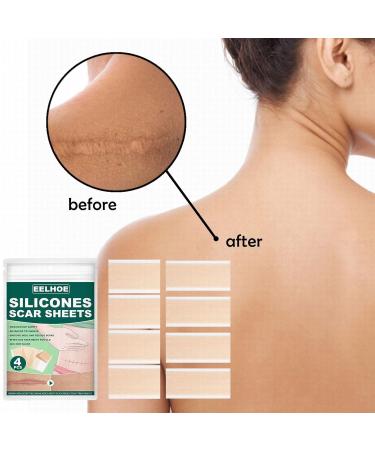 Collagen Peptide Silicone Scar Patch - Fade Stretch Marks, Burn Scars & Smooth Skin - Dime Super Firm - One Size - Buy Online on GoSupps.com