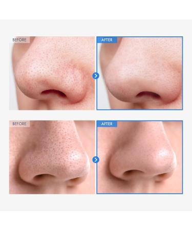 AHA Deep Cleansing Facial Oil with Jojoba & Tea Tree Oil | Korean Blackhead Remover & Pore Cleaner - 145ml - Buy Online on GoSupps.com