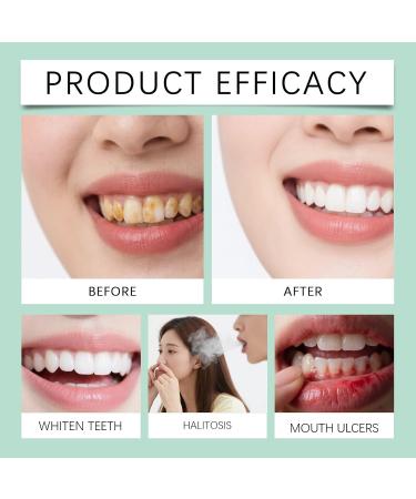 Gentle Herbal Mint Toothpaste - Daily Oral Clean Teeth Brightening Gum Care & Long-Lasting Fresh Breath(2PCS) - Buy Online on GoSupps.com