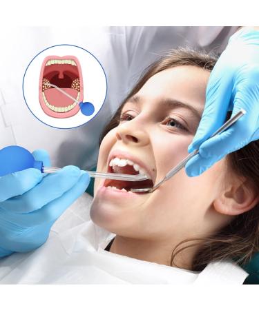 Premium Tonsil Stone Remover Tool Set | Cupping Glass & Tooth Mirror | Effective Solution for Bad Breath & Oral Care - Buy Online on GoSupps.com