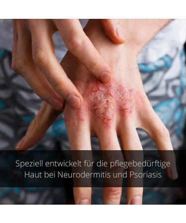 Naturprodukte Schwarz NeuroPsori Cream - Special Care for Psoriasis & Neurodermatitis 100ml | International Shipping - Buy Online on GoSupps.com