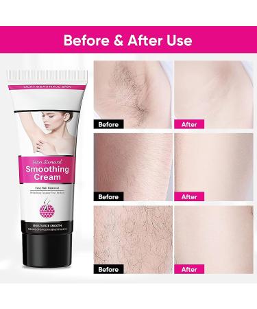 Painless Hair Removal Cream for Women - Fast & Effective Depilatory Cream for Underarms, Bikini, Pubic, and Body - 1 pcs - Buy Online on GoSupps.com