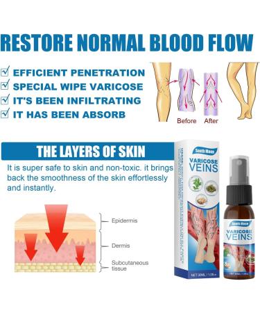 2pcs Veinhealing Varicose Veins Treatment Spray Veinhealing Varicose Veins Spray Vein Healing Varicose Veins Treatment Spray for Legs Varicose Veins Miracle Spray (30ml) - Buy Online on GoSupps.com