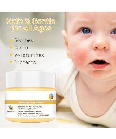 Soothing anti-itch cream 50 ml soothing skin lotion balm for itchy skin moisturizing care for sensitive areas daily use family application - Buy Online on GoSupps.com