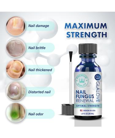 Extra Strength Toenail Fungus Treatment - Fast Acting Home Solution for Healthy Nails | Repair & Renew Damaged Toenails in One Week - Buy Online on GoSupps.com