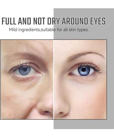 Lutein Eye Essence Oil Eye Serum Oil Solution Roll Ball Lutein Essential Oil Vc Lutein Eye Essence Oil Lutein Eye Serum Firming Anti-Aging Eye Serum for Eye Bags Dark Circles (2) - Buy Online on GoSupps.com