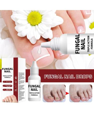 Nail Repair Liquid | Hand and Foot Repair Solution for Damaged Nails | Deep Moisturizing 15ml All Seasons For Salons Seniors Men Athletes Women and Adults - Buy Online on GoSupps.com