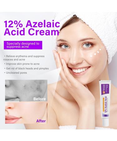 Azelaic Acid Serum Skin Brightening Acid Skin Care Treatment for All Skin Types Fade and Repair Dark Spots 20g - Buy Online on GoSupps.com