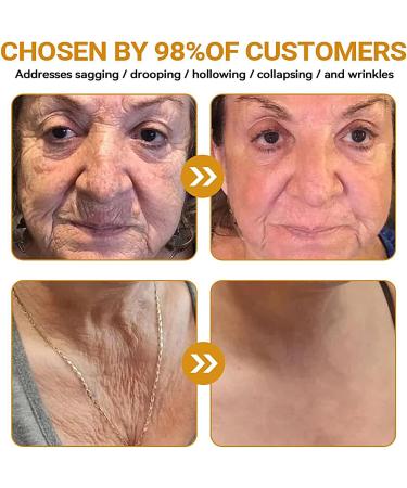 Skin Repair Cream | Natural Soothing and Calming Lotion 60g - Skin Barrier Repair | For Women and Men - Hands Feet Face Body Neck Use - Buy Online on GoSupps.com