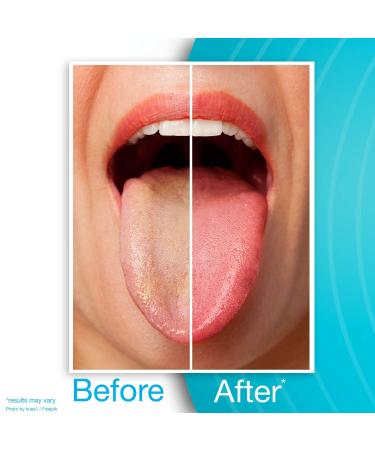 Dr. Tung's Tongue Cleaner - 1 Count (Colors May Vary) | Pack of 1 - Buy Online on GoSupps.com