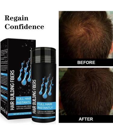 Professional Quality Black Hair Building Fibers for Thinning Hair - Hair Loss Concealer for Women and Men - Covers Bald Spots - Fiber Hair Powder - Buy Online on GoSupps.com