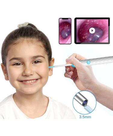 1080p Full HD Ear Wax Removal Otoscope with 9 Pcs Ear Set - Ear Camera - Earwax Remover Cleaner Kit White - Buy Online on GoSupps.com