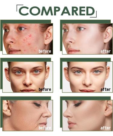 Whitening Rejuvenating Essence Licorice Extract Whitening Essence Women Face Firming Tightening Serum Licorice Extract Wrinkle Removal Essence Moisturizing Fast Absorbing Brightness Bloom Young Skin - Buy Online on GoSupps.com