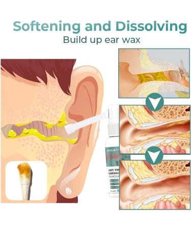 GFOUK Anti Tinnitus Earwax Removal Spray - 1pcs Earwax Dissolving & Cochlear Blockage Remover - Buy Online on GoSupps.com