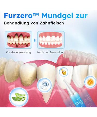 Oral Gel for Gum Treatment Gum Gel Gum Treatment Gel Gum Protection Therapy Gel for Gum Restoration and Teeth Whitening (8PC) - Buy Online on GoSupps.com