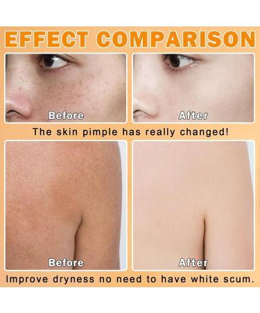 Organic Turmeric Soap Bar | Deep Cleansing & Moisturizing for All Skin Types | Handmade Face & Body Soap 3.88 oz - Buy Online on GoSupps.com