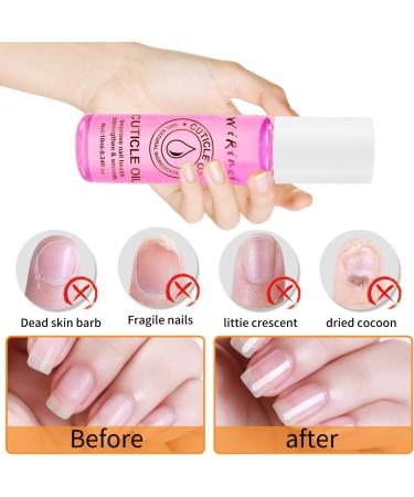 Cuticle Oil for Nail Care - Peach Nails Oil with Organic Vitamin E & B Cuticle Oil for Nails Nail Oil Soothe Moisturize with Dropper Design to Prevent Nail Cracking and Dry - Buy Online on GoSupps.com