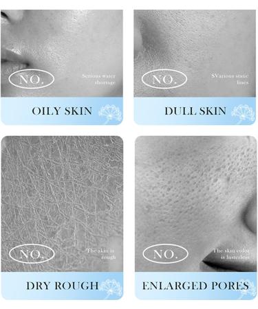 Rose Hyaluronic Acid Rose Water Face Mist Rose Toner for Face Face Mist Spray Hydrating Rose Toner for Face Skincare Rose Smoothing Toner for Face Face with 98% Rose & Hyaluronic Acid - Buy Online on GoSupps.com