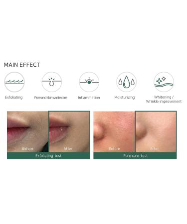 SOME BY MI AHA-BHA-PHA 30 Days Miracle Toner (150ml) | Functional Tea Tree Toner for Clear Skin - Shop Internationally - Buy Online on GoSupps.com