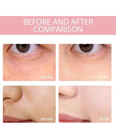 Peach 70 Niacin Serum 70% Peach Niacinamide Serum Dark Spot Correcting Glow Serum Hydrating Face Serum for smoother & glower Skin Texture in Spot-prone Skin Face Serum for Women For Dull Tired Skin - Buy Online on GoSupps.com