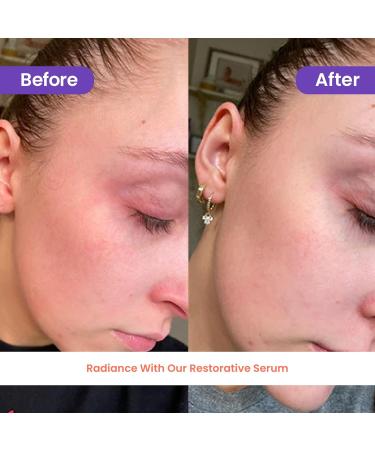 Vieve's Leaves Facial Serum - Smoothing & Refreshing Vegan Serum with Aloe & Fruit Stem Cells for Sensitive Skin - Cruelty-Free eCommerce  - Buy Online on GoSupps.com