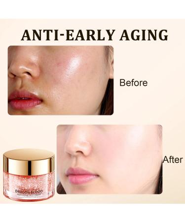 Retinol Placenta Dragon Blood Cream Dragons Blood Easy Cream Dragon Blood Anti Aging Face Cream Dragons Blood Cream For Firming Anti Wrinkle Nourishing & Hydrating For All Skin Types 50g - Buy Online on GoSupps.com