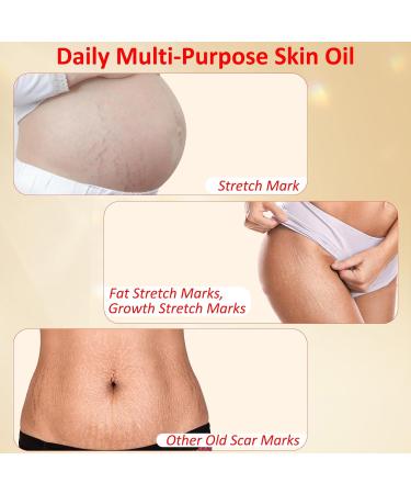 Stretch Mark Oil for Pregnancy | Natural Skincare Massage Oil for Scars & Stretch Marks | Pre & Postpartum Care 4.2 fl. oz - Buy Online on GoSupps.com