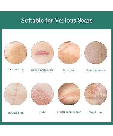 Skin Eternal Scar Removal Cream - Effective Stretch Mark and Scar Treatment for Men and Women - Great for Burns and Face Skin - One Size Fits All - Buy Online on GoSupps.com