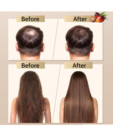 LATORICE Batana Oil for Hair Growth - 100% Natural Hair Loss Prevention & Thickness Enhancer for Men & Women - Authentic Honduras Oil - Buy Online on GoSupps.com