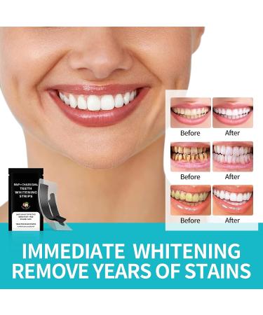 Professional Teeth Whitening Strips Kit - 14 Treatments for Sensitive Teeth - Mint Flavored 28 Dental Whitener Strips - Buy Online on GoSupps.com