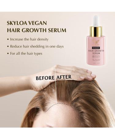 Veganic Hair Growth Serum - Natural Oil for Men & Women | Effective Hair Regrowth Treatment | 30ml Thinning Hair Solution - Buy Online on GoSupps.com