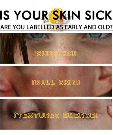 Vitamin C Serum for Face Vitamin C Dark Spot Corrector Age Spot Remover for Face Brightening Dark Spots Remover for Face Anti Aging Serum for Women & Men Essence Skincare Serum with 20% Vitamin C - Buy Online on GoSupps.com