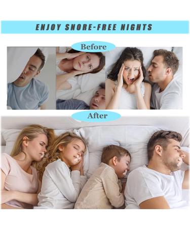 Gelanori Mouth Tape 90 Count Sleep Strips - Advanced Gentle Nose Breathing Support (90 pcs) - Buy Online on GoSupps.com