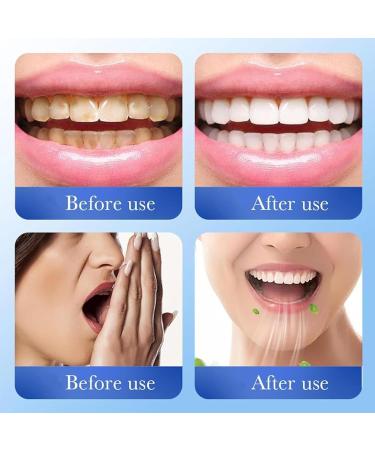 2PC Collag ne En Poudre Blanchissante Dents Collagum Blanchiment Dentaire Collagene Poudre Hydroxyapatite Collagum Teeth Whitening Pour Enlever Les Taches Et Blanchir Les Dents - Buy Online on GoSupps.com