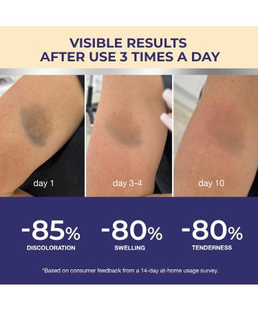 Arnica Bruise Cream Extra Strength: Fast Healing Arnica Cream for Bruising Swelling Thin Skin-Enhanced Recovery Vitamin K Creams With Arnica Montana VK C&E Soothing Hydrating for senior Adult Kid 4 Ounce - Buy Online on GoSupps.com