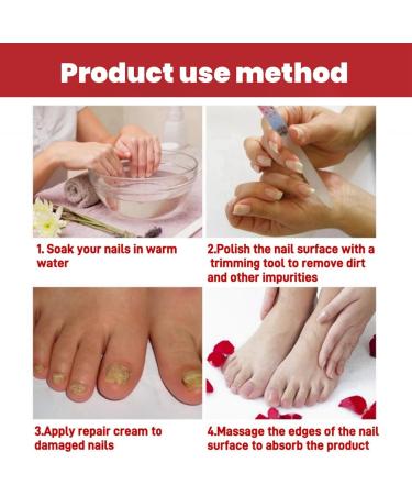 Fungal Nail Treatment Cream Antifungal Nail Polish Cream Nail Fungus Treatment for Toenail Strong Anti-Fungal Toenail Cream Nail Improve Cream Nail Repair Cream for Thick Cracked Discolored Nails - Buy Online on GoSupps.com
