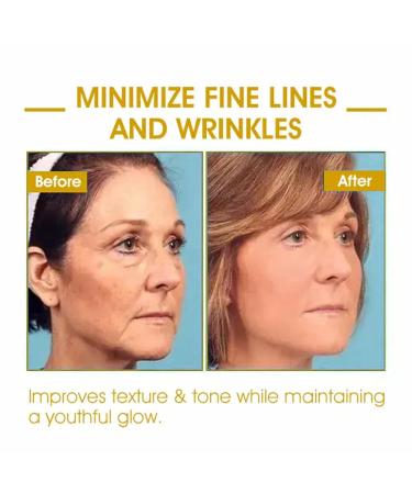 Lefun Skin Firming Rejuvenating Oil | Best Dry Skin Moisturizer & Hydrating Body & Face Massage Oil for Wrinkles Sagging & Sun Damaged Skin - 1 Fl Oz - Buy Online on GoSupps.com