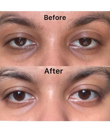 Apple Eye Gel - Plantbased Hydrating Eye Gel for Under & Around Puffy Eyes Dark Circles Eye Bags Crows Feet and Wrinkles Vitamin C - Vitamin E Collagen - Anti Ageing Eye Gel - Buy Online on GoSupps.com