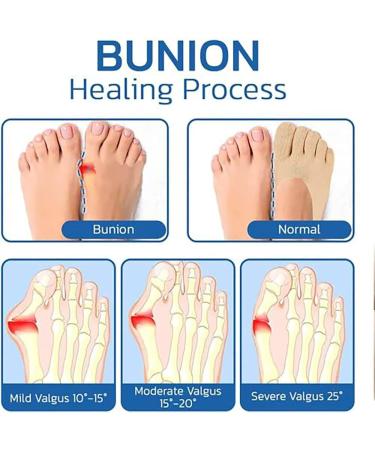 Anti Bunions Health Socks - 5 Pairs Orthopedic Toe Socks for Bunion Relief and Comfort - Breathable Split Toe Design (Black) - Buy Online on GoSupps.com