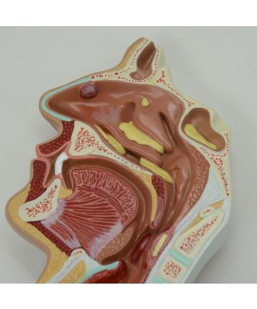 JUJNE Nasopharyngeal and Laryngeal Lesion Model Nasal Cavity Pathological Model Nasal Cavity Magnification Model is Suitable for Medical Teaching - Buy Online on GoSupps.com