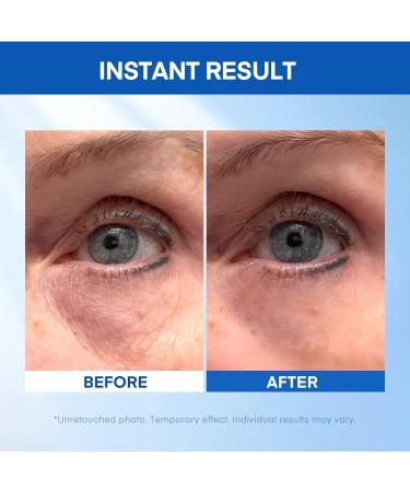 Instant Under Eye Lift Serum - Reduces Eye Bags Wrinkles Puffy Eyes Dark Circles & Crow s Feet in Minutes - Advanced Firming Polysaccharide Formula for Mature Skin - 20 mL 0.68 Ounce (Pack of 1) - Buy Online on GoSupps.com