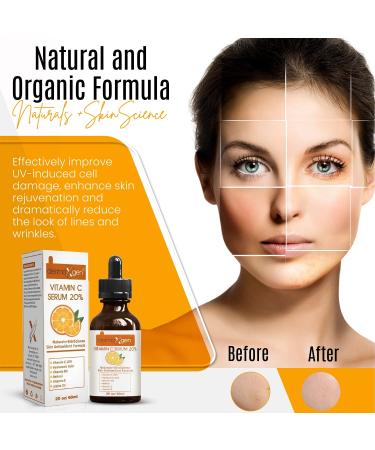 20% Vitamin C Serum with Hyaluronic Acid & Retinol - Organic Anti-Aging Moisturizer for Youthful Skin (2 FL OZ - Buy Online on GoSupps.com