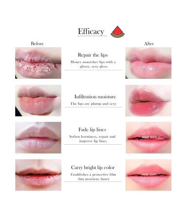 10 PCS Bee Lip Balm Honey Pot, Strawberry, Watermelon, Apple Lime, Cherry, Mint, Coconut, Aloe, Grapes & Peach Flavors, Honey Lip Balm Bulk, Moisturizing Lip Mask Overnight, Reduce Lip Lines Set A - Buy Online on GoSupps.com