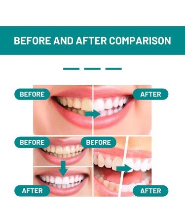 Furzero Smartsmile Oral Mouthwash - Teeth Whitening & Fresh Breath Care (3PCs) | Awzlove Total Care for Tooth & Gum Health - Buy Online on GoSupps.com