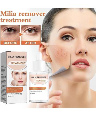 (100% 5 star) 4Pcs Milia Clearing Essence Milia Remover Eye Serum | Milia Remover Milia Spot Treatment | Miliary Repair Essence | Moisturize Skin | Improve Skin Texture for All Skin Types - 30ml/1fl.oz - Buy Online on GoSupps.com