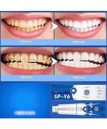 Sp-Y6 Probiotic Toothpaste 3 Day Whitening Aromatic Toothpaste Brightening and Stain Removal Toothpaste Toothpaste for Fresh Breath - Buy Online on GoSupps.com