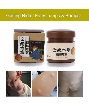 Amdieu Magical Lipoma Elimination Cream - Break Down Fat Tissue, Lump-Free Lipoma Treatment for Whole Body - 0.7 oz (Pack of 1) - Buy Online on GoSupps.com