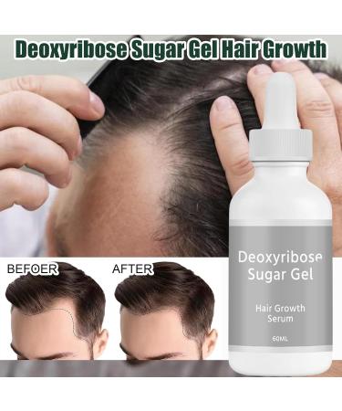 Esncddym Deoxyribose Sugar Gel Hair Ribose Sugar Growth Oil Mild Thickening Oil for Scalp Strengthening - Buy Online on GoSupps.com