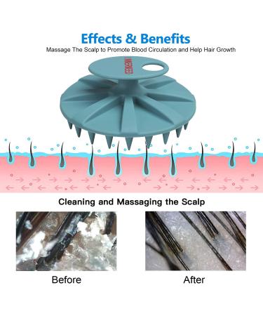 Scalp Massager Shampoo Brush - Wet & Dry Head Scrubber for Hair Growth & Dandruff Removal - Soft Silicone Bristles - Dark Green - Buy Online on GoSupps.com