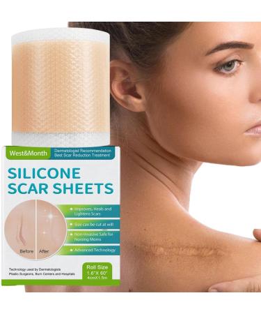 Teksome Scar Tape for Body - 1.5m Stretch Mark Remover Strips | Silicone Gel Tape for Scars & Stretch Marks - Buy Online on GoSupps.com